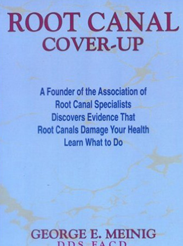 root-canal-coverup